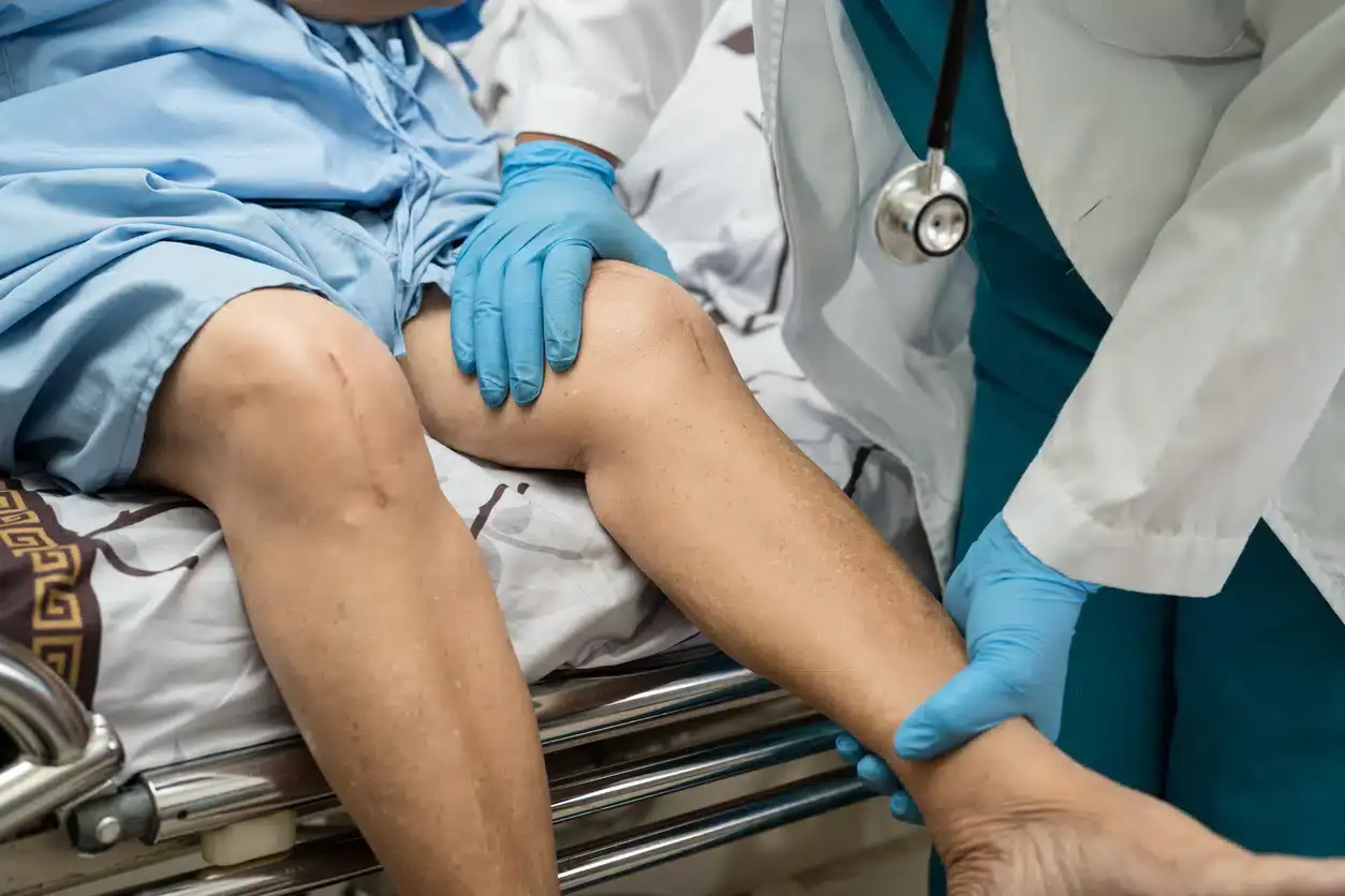 knee replacement physio